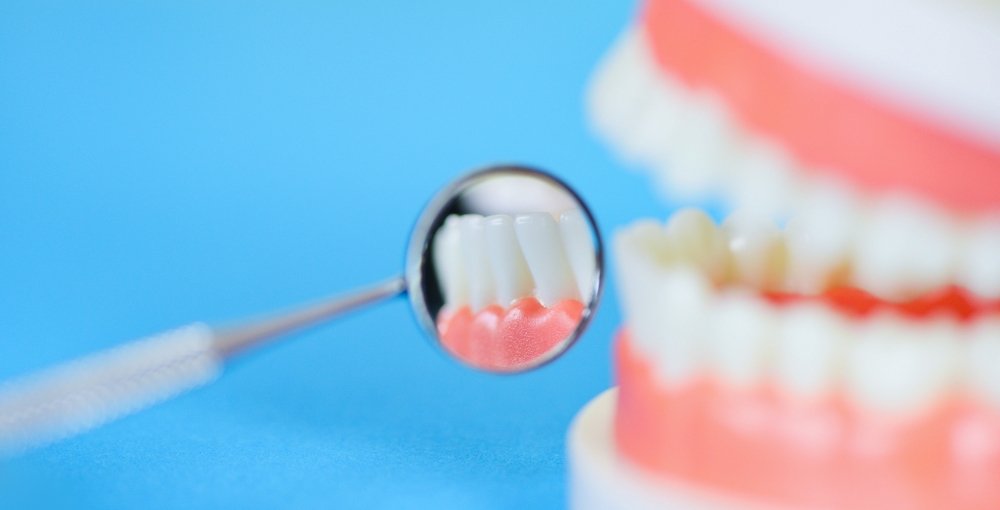 歯へのダメージが少ない