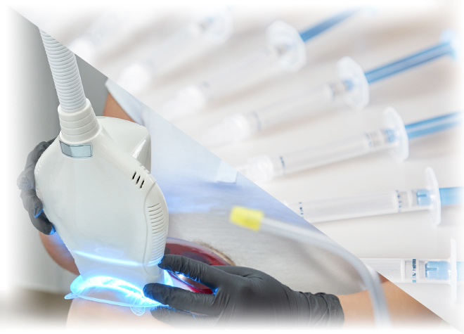 デュアルホワイトニング